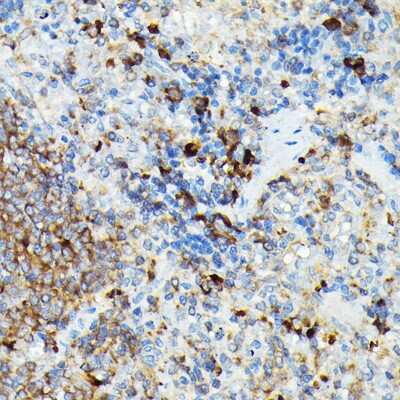 Immunohistochemistry-Paraffin: CYLD Antibody - BSA Free [NBP2-92436]