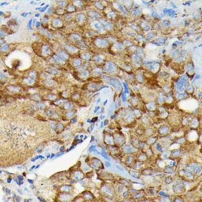 Immunohistochemistry-Paraffin: CYLD Antibody - BSA Free [NBP2-92436]