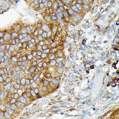 Immunohistochemistry-Paraffin: CYLD Antibody - BSA Free [NBP2-92436]