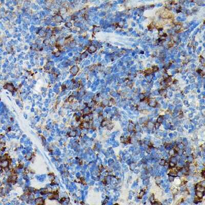 Immunohistochemistry-Paraffin: CYLD Antibody - BSA Free [NBP2-92436]