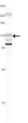 Simple Western: CYLD Antibody [NB100-56461]