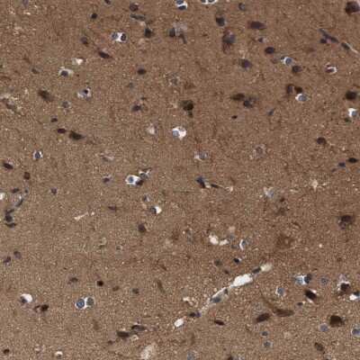 Immunohistochemistry-Paraffin: CYLN2 Antibody [NBP1-85569]