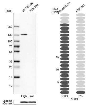 Western Blot: CYLN2 Antibody [NBP1-85569]