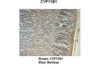Immunohistochemistry: CYP11B1 Antibody [NBP1-68883]