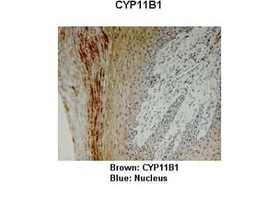 Immunohistochemistry: CYP11B1 Antibody [NBP1-68883]