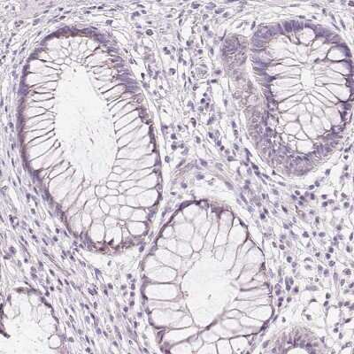 Immunohistochemistry-Paraffin: CYP11B1 Antibody [NBP2-49223]