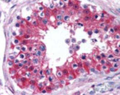 Immunohistochemistry: CYP1B1 Antibody [NBP2-50551]