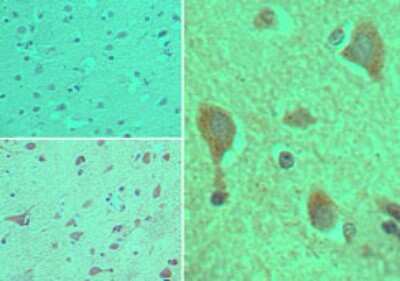 Immunohistochemistry-Paraffin: CYP1B1 Antibody [NBP2-24722]