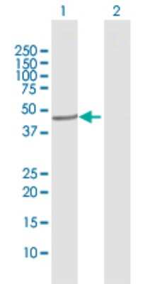 Western Blot: CYP20A1 Antibody [H00057404-D01P]