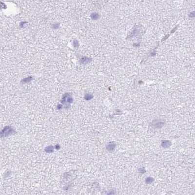 Immunohistochemistry-Paraffin: CYP21A2 Antibody [NBP2-13893]