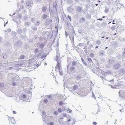 Immunohistochemistry-Paraffin: CYP21A2 Antibody [NBP2-13893]