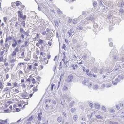 Immunohistochemistry-Paraffin: CYP21A2 Antibody [NBP2-13893]