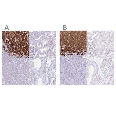 Immunohistochemistry-Paraffin: CYP21A2 Antibody [NBP2-13893]