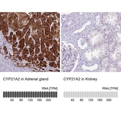 Immunohistochemistry-Paraffin: CYP21A2 Antibody [NBP2-13893]