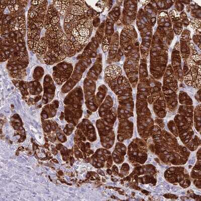Immunohistochemistry-Paraffin: CYP21A2 Antibody [NBP2-13893]