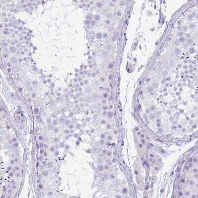 Immunohistochemistry-Paraffin: CYP21A2 Antibody [NBP2-13893]
