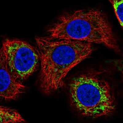 Immunocytochemistry/ Immunofluorescence: CYP24A1 Antibody [NBP1-85495]