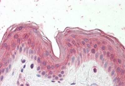 Immunohistochemistry-Paraffin: CYP24A1 Antibody [NBP1-52111]