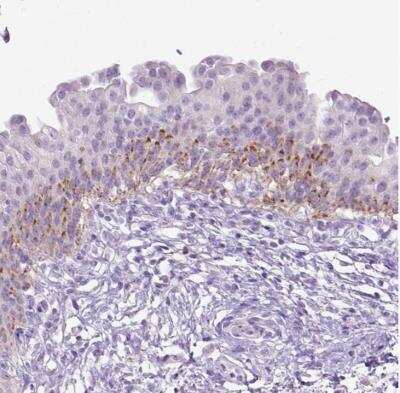 Immunohistochemistry-Paraffin: CYP24A1 Antibody [NBP1-85495]