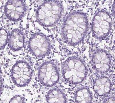 Immunohistochemistry-Paraffin: CYP24A1 Antibody [NBP1-85495]