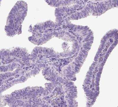Immunohistochemistry-Paraffin: CYP24A1 Antibody [NBP1-85495]