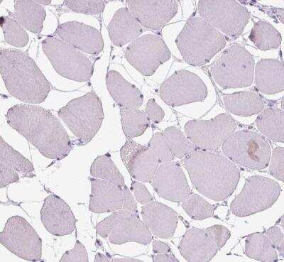 Immunohistochemistry-Paraffin: CYP24A1 Antibody [NBP1-85495]