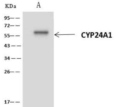 Immunoprecipitation: CYP24A1 Antibody [NBP3-05981]