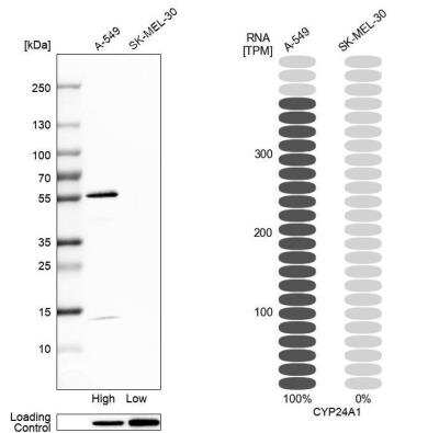 Western Blot: CYP24A1 Antibody [NBP1-85495]