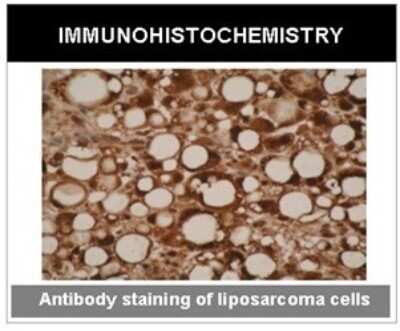Immunohistochemistry: CYP26A1 Antibody (F27P6A1) - BSA Free [NBP2-50193]