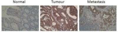 Immunohistochemistry: CYP26A1 Antibody (F27P6A1) - BSA Free [NBP2-50193]