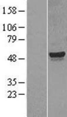 Western Blot: CYP26A1 Overexpression Lysate [NBL1-09679]