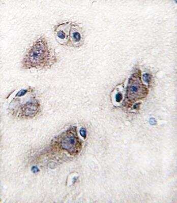 Immunohistochemistry-Paraffin: CYP26C1 Antibody - BSA Free [NBP3-06730]