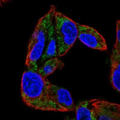 Immunocytochemistry/ Immunofluorescence: CYP27A1 Antibody [NBP2-32433]
