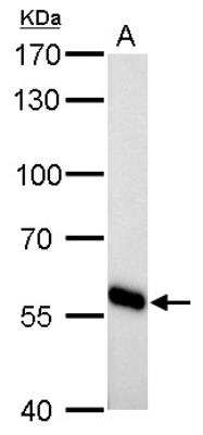 Western Blot: CYP27A1 Antibody [NBP2-16062]