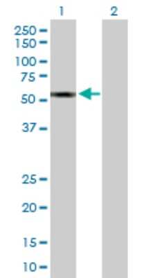 Western Blot: CYP2A13 Antibody [H00001553-D01P]