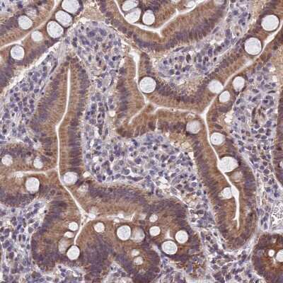 Immunohistochemistry-Paraffin: CYP2R1 Antibody [NBP2-13895]
