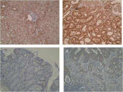 Immunohistochemistry: CYP2R1 Antibody (M26-P6H1) - BSA Free [NBP2-50204]