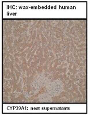Immunohistochemistry: CYP39A1 Antibody (M30P6D6) - BSA Free [NBP2-50206]