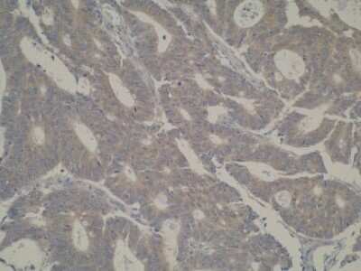 Immunohistochemistry: CYP39A1 Antibody (M30P6D6) - BSA Free [NBP2-50206]