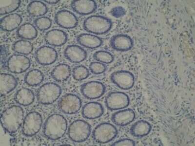 Immunohistochemistry: CYP39A1 Antibody (M30P6D6) - BSA Free [NBP2-50206]