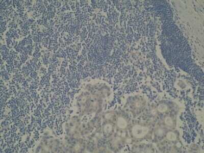 Immunohistochemistry: CYP39A1 Antibody (M30P6D6) - BSA Free [NBP2-50206]