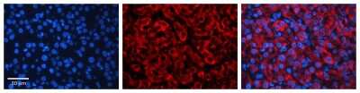 Immunohistochemistry: CYP3A43 Antibody [NBP1-62393]
