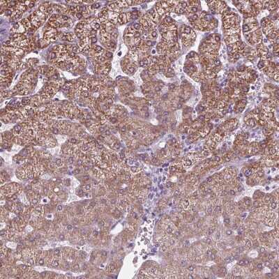 Immunohistochemistry: CYP3A43 Antibody [NBP2-49482]