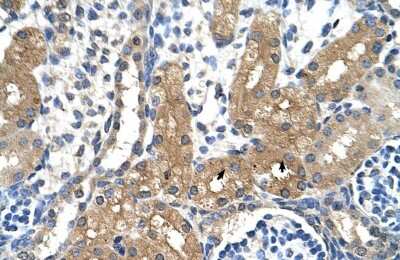 Immunohistochemistry-Paraffin: CYP4A22 Antibody [NBP1-80495]