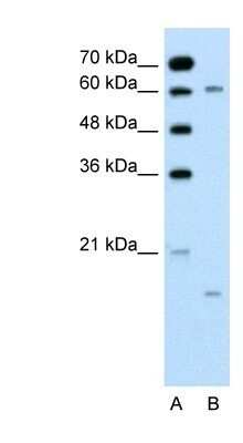 Western Blot: CYP4A22 Antibody [NBP1-80495]