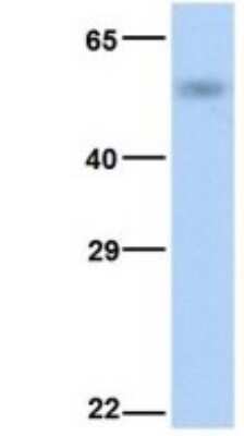 Western Blot: CYP4B1 Antibody [NBP1-69677]