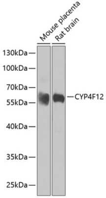 Western Blot: CYP4F12 AntibodyBSA Free [NBP2-92529]