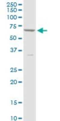 Western Blot: CYP4V2 Antibody [H00285440-B01P]