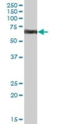 Western Blot: CYP4V2 Antibody [H00285440-B01P]
