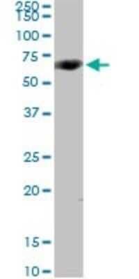 Western Blot: CYP4V2 Antibody [H00285440-D01P]